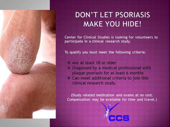 Plaque Psoriasis ster TX (Clinical Trial 27688)