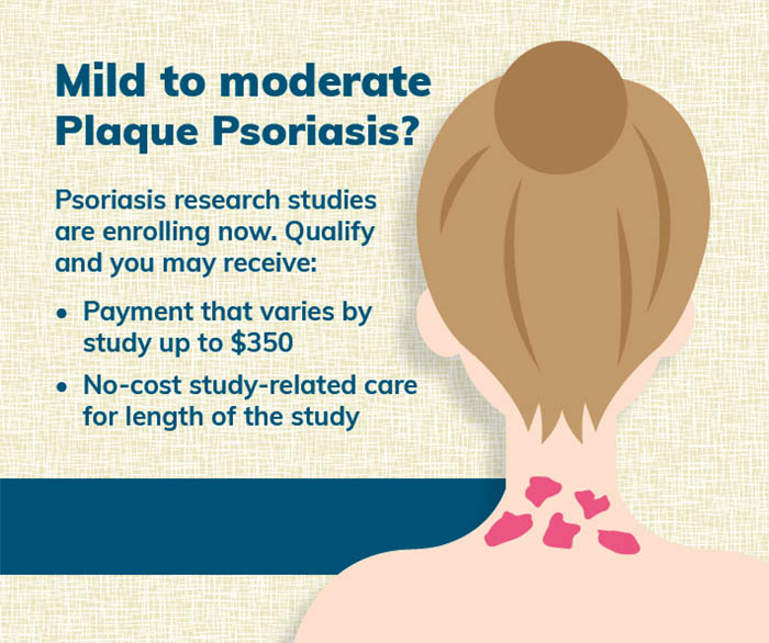Plaque Psoriasis Multiple Locations in the US (Clinical Trial 44259)