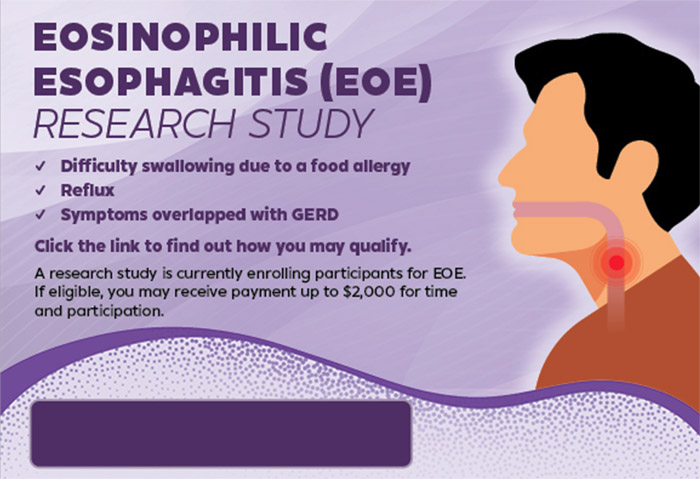 <b>Eosinophilic Esophagitis (EoE) - Multiple Locations in the US</b>