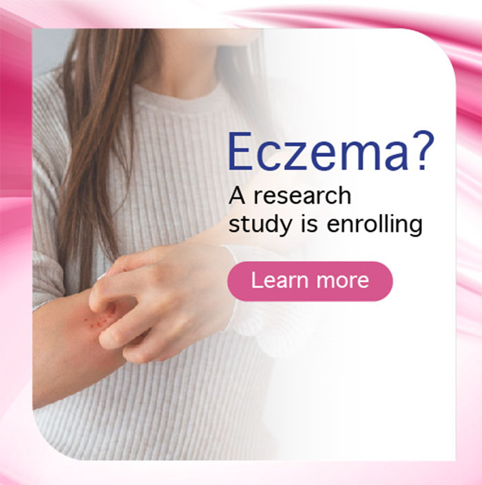 <b>Eczema - Multiple Locations in the US</b>