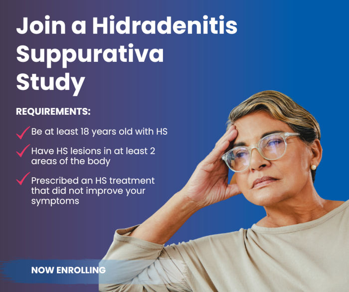 Hidradenitis Suppurativa Multiple Locations in the US (Clinical Trial